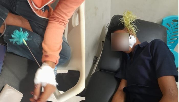 Aksi Tawuran Geng Motor Pecah di Palu, Polisi Laporkan 2 Korban Kena Busur di Tangan dan Pipi