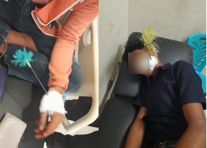 Aksi Tawuran Geng Motor Pecah di Palu, Polisi Laporkan 2 Korban Kena Busur di Tangan dan Pipi